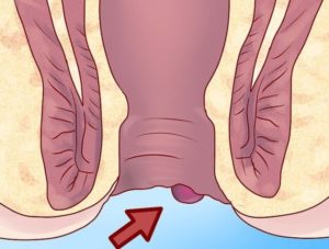 Белая пена из заднего прохода