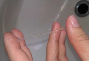 Белые выделения после постинора