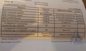 Выявили кандида и уреаплазма