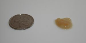 Откашливаются коричневые куски