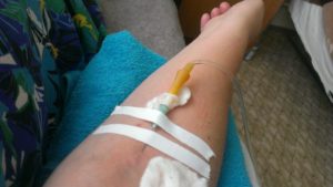 Можно ли делать у запястья капельницу в вену