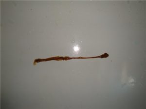 Вытянул длинного червя, с заднего прохода