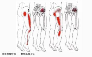 Болит поясница и тянет ноги