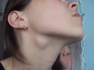 Увеличение лимфатических узлов по челюстью