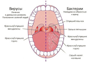 Поцарапала горло