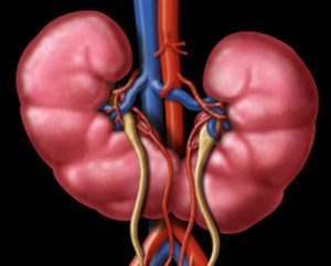 Синдром Фрейли