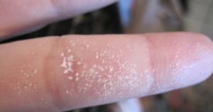 Белизна попала на кожу