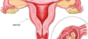 Месячные после лишения девственности