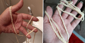 Вытянул длинного червя, с заднего прохода