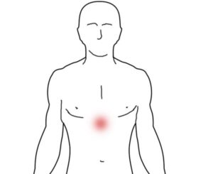 Боль в области солнечного сплетения