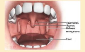 Разрастание ниже миндалины