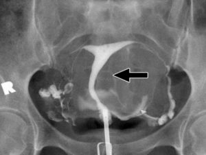 Ограничения после Гсг