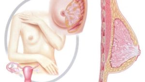 Одна грудь болит перед месячными из за уплотнения