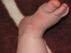 Малыш 5 месяцев трёт ножку об ножку