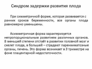 СЗРП 1 степени