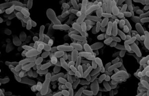 Гарднерелла