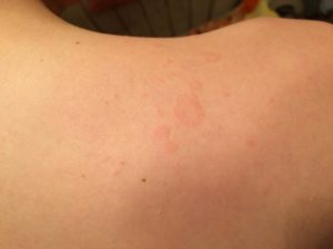 Не могут понять что это за пятна