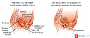 Сильная, резкая боль, при глубоком проникновении