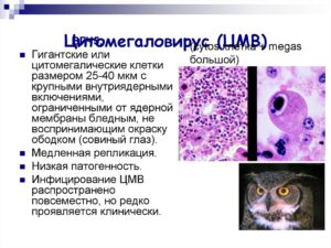 Вирус герпеса и цитомегаловирус