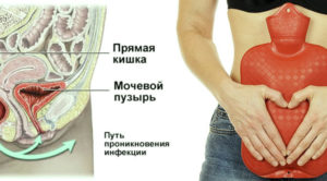 Кишечник давит на мочевой