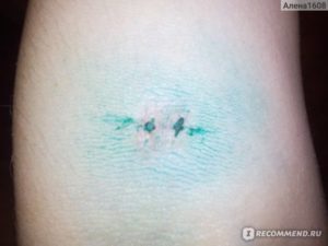 Осталась нитка после снятия швов