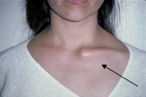 Горит шея спереди,