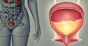 Кишечник давит на мочевой