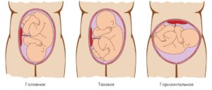 Дрожание плода при беременности