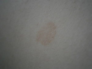 Не могут понять что это за пятна