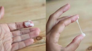 Белые выделения и сгустки из влагалища