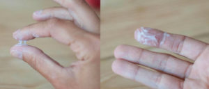 Нет выделений во влагалище