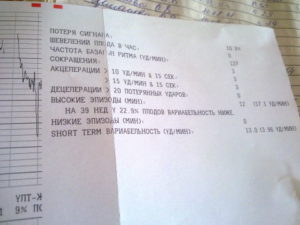 Расшифровка КТГ 40 недель