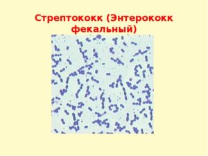 Фекальный энтерококк в мазке зева