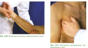 Локтевой лимфоузел?