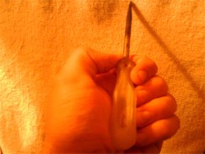 Проткнул отверткой Руку что делать