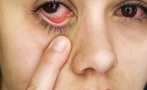 Ощущение воды в глазах