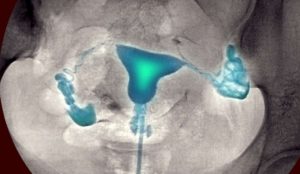 Ограничения после Гсг