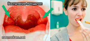 Болит горло и закладывает уши