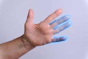 В большом пальце руки ощучение что бьет током