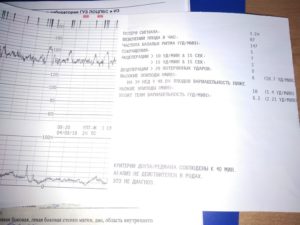 Насколько информативно ктг плода если я не ощущала шевелений