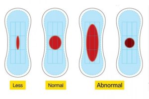 Месячные после лишения девственности