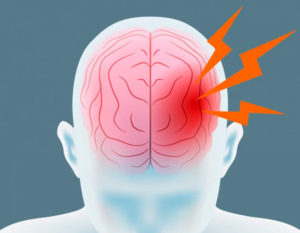 Острая головная боль в правом полушарии