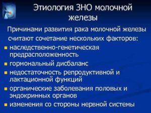 Поставлен диагноз: ЗНО правой молочной железы T3N1M0