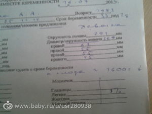 СЗРП 1 степени