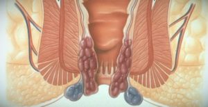 Белая пена из заднего прохода