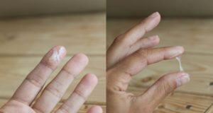 Выделения стали жидкими как вода