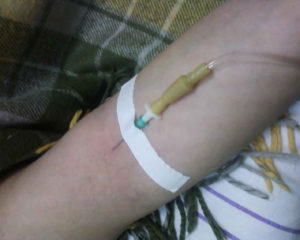 Можно ли делать у запястья капельницу в вену