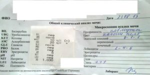 Анализ мочи