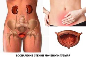 Боль в правом боку после полового акта