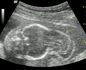 Визуализация затруднена